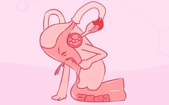 【健康科(kē)普】痛經不(bù)再難熬：教你(nǐ)有(yǒu)效應對(duì)